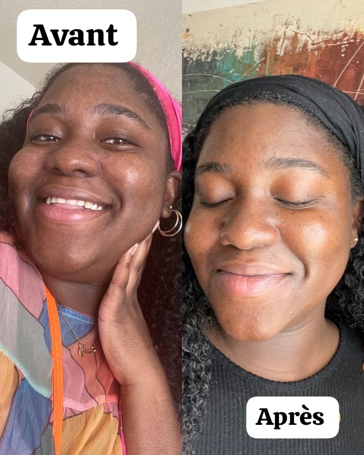 Kit Complet Routine Jour & Nuit aux curcuma et au collagène