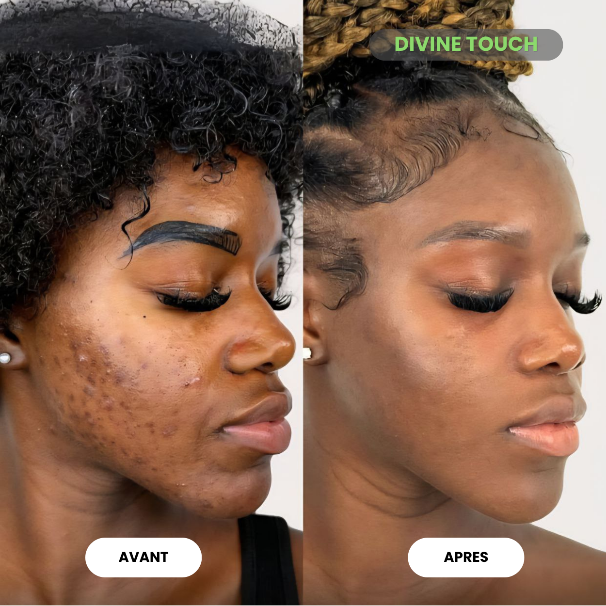 Les Meilleurs Cotons aux curcuma  (ABIDJAN)