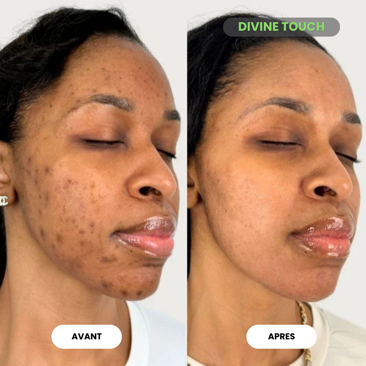 Duo soin visage collagène