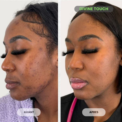 Duo soin visage collagène