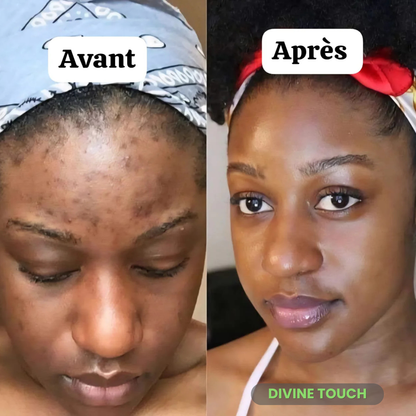 La meilleur routine jour et nuit au curcuma ( Abidjan )