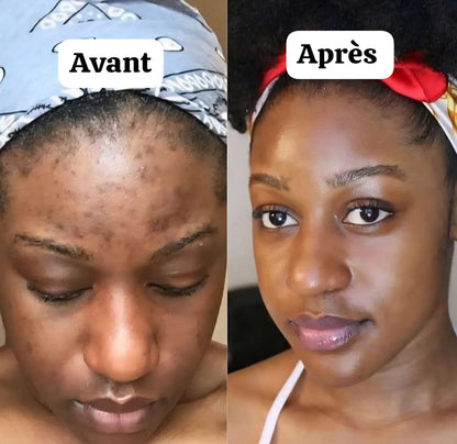 Duo soin visage collagène