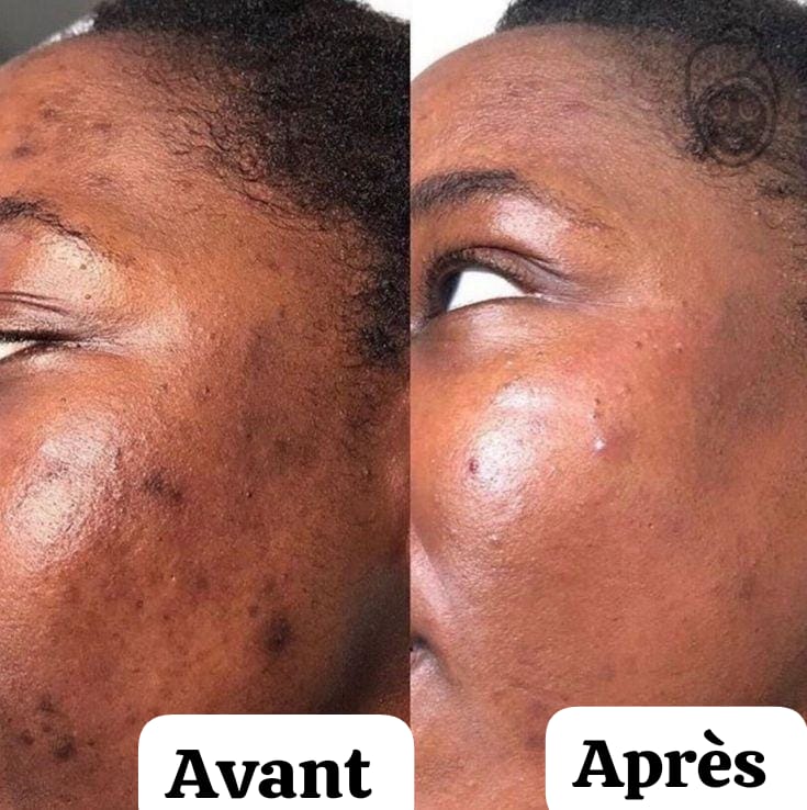 KIT CURCUMA : Coton curcuma + Sérum au curcuma + Masque au curcuma + Crème solaire La Roche Posail