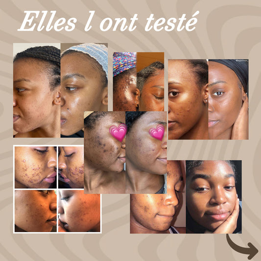 Les Meilleurs Cotons aux curcuma  (ABIDJAN)