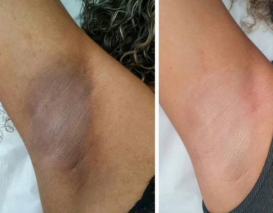 SEOUL 1988 DUO ÉCLAT PARFAIT - Spécial Peaux Noires Sénégalaises