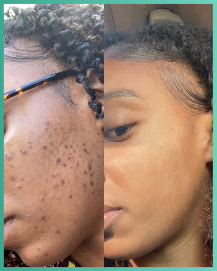 Kit curcuma Divin Touch: 1 Boite Coton curcuma + 1 Sérum au curcuma + 1 Masque au curcuma