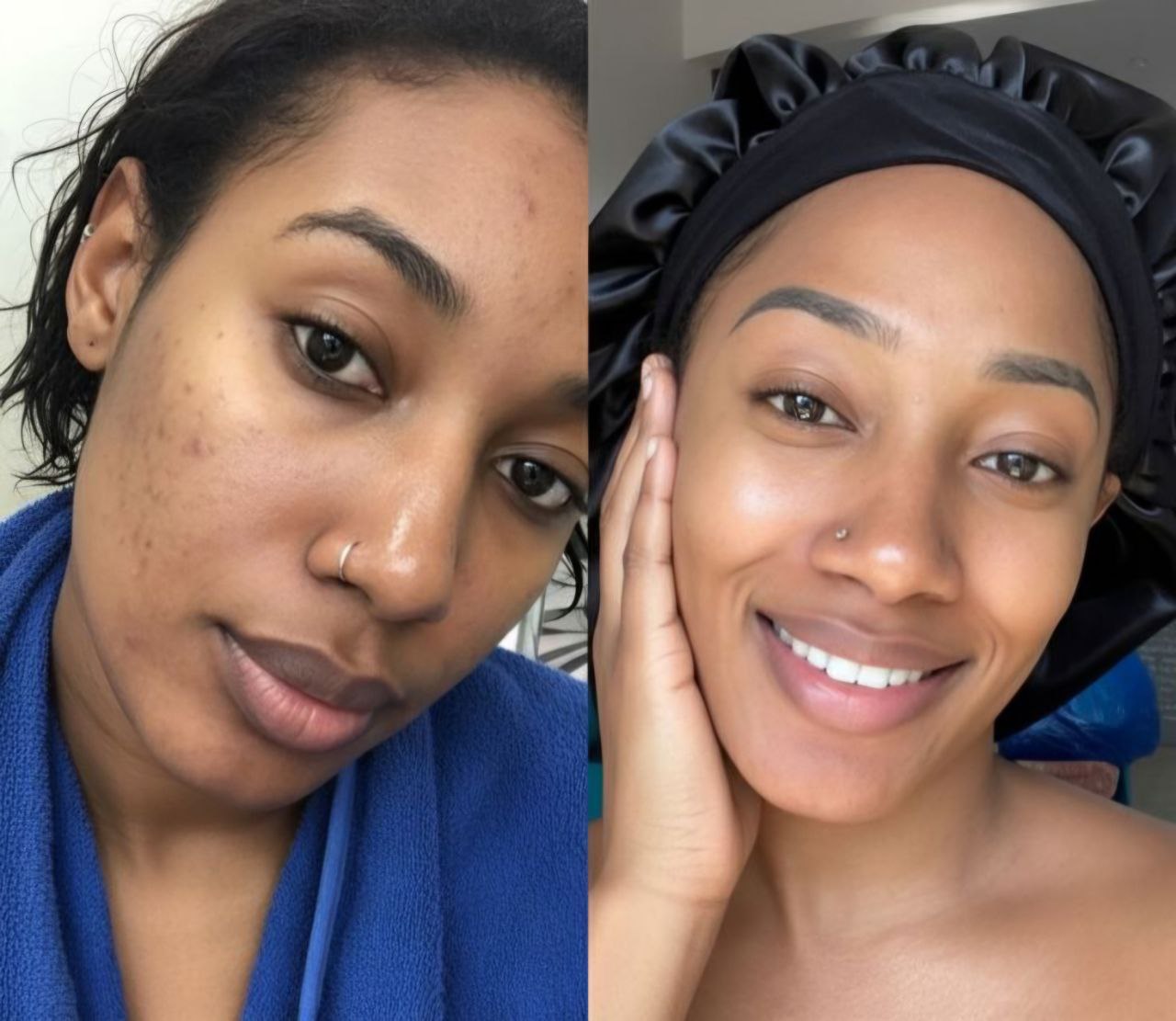 Kit Complet Routine Jour & Nuit aux curcuma et au collagène