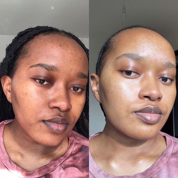 Kit Complet Routine Jour & Nuit aux curcuma et au collagène